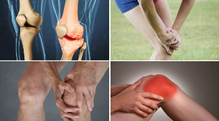 the symptoms of osteoarthritis