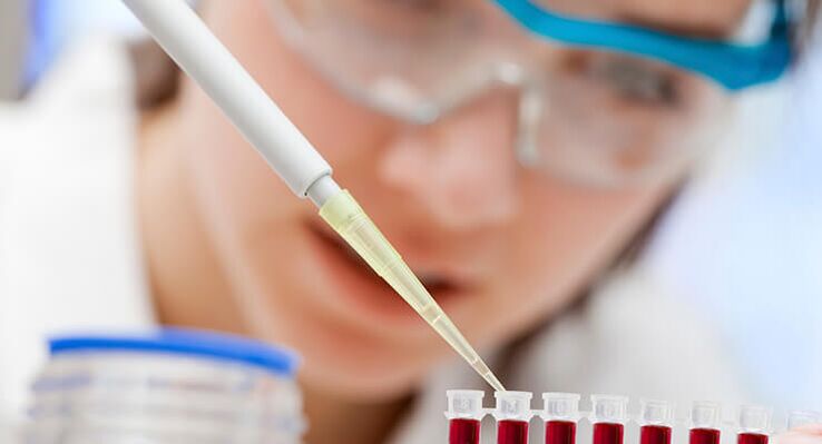 blood test for hip arthritis