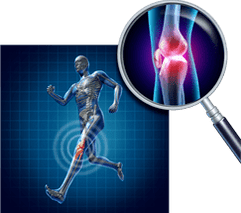 Knee joint osteoarthritis